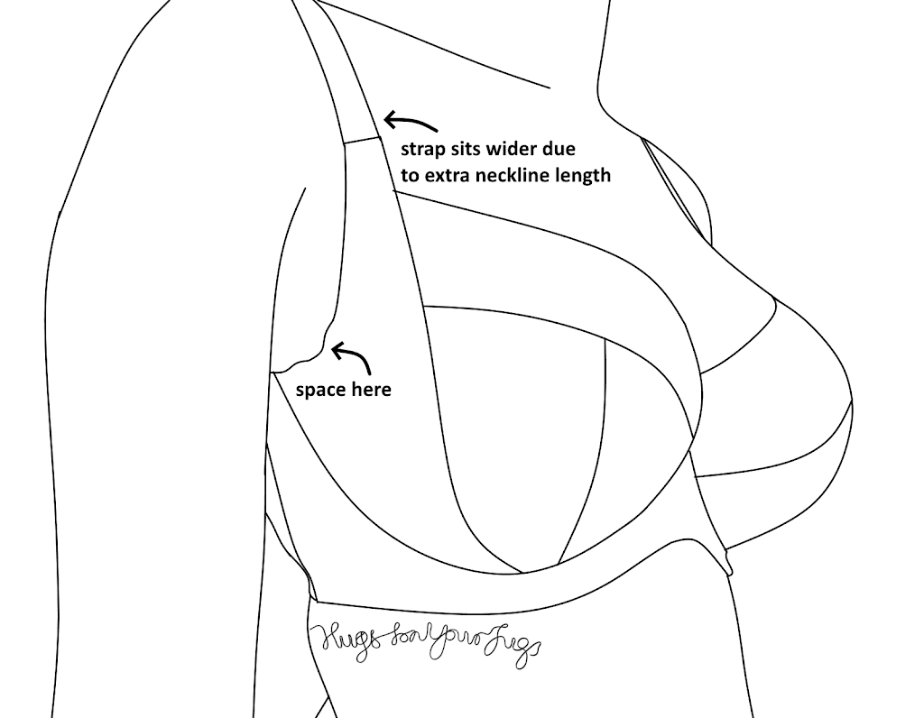 Why the Omega Alteration keeps messing up your armpit (and how to fix it)