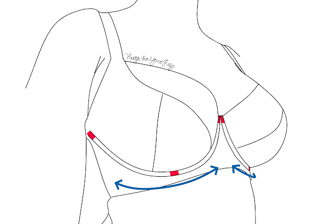 A too firm wire causing pressure points at the gore and bottom A too firm wire causing pressure points at the gore and bottom