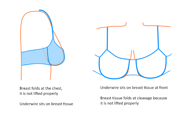 Poorly fitting bra diagram unsupportive