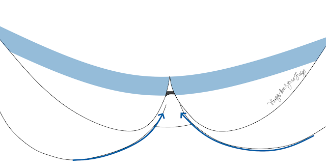 Diagram showing a floating gore and some breast tissue remaining unsupported Diagram showing a floating gore and some breast tissue remaining unsupported