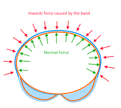 Normal force caused by the tightness of the band