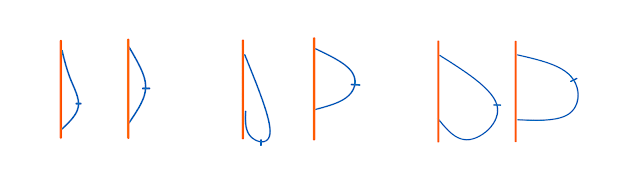 Shape of unsupported vs well supported breasts, with supported breasts being lifted and rounded