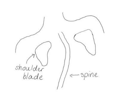 Diagram showing a spine with a curve in it to demonstrate scoliosis